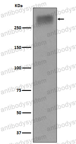 Anti-TG/Thyroglobulin Antibody (R1H79)