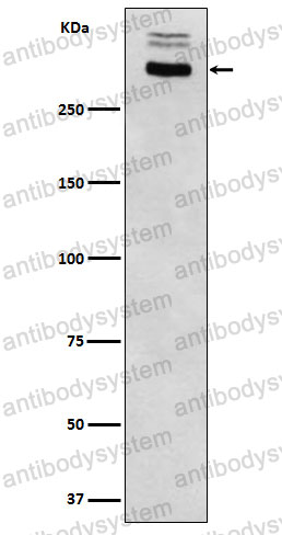 Anti-TG/Thyroglobulin Antibody (R1H80)
