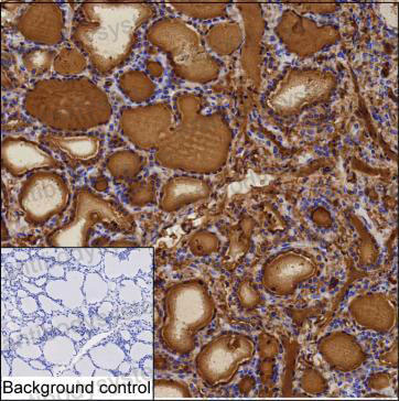 Anti-TG/Thyroglobulin Antibody (R2X35)