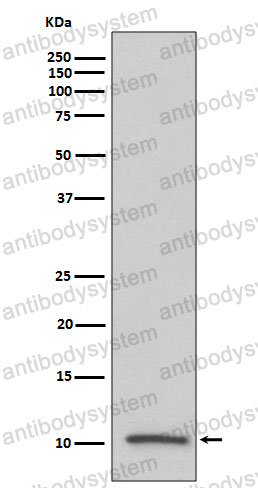 Anti-IGF2 Antibody (R1H81)