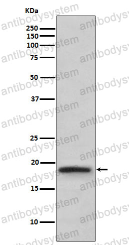 Anti-LTA/TNF-beta Antibody (R1H82)