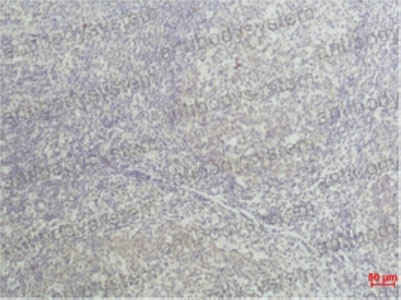 Anti-TNFa/TNF-alpha Antibody (R2X40)