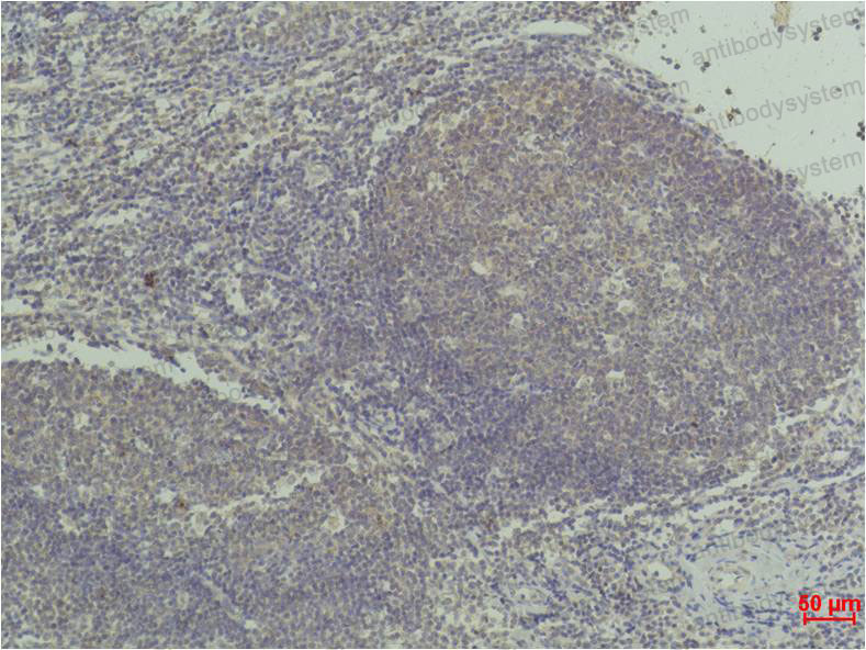 Anti-TNFa/TNF-alpha Antibody (R2X41)