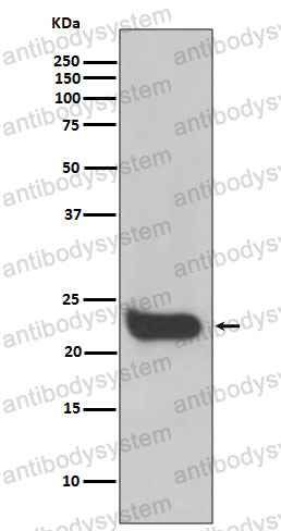 Anti-IFNB1/IFN-beta Antibody (R1H83)