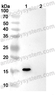 Anti-Human IFNG/IFN-gamma Antibody (SAA0266)