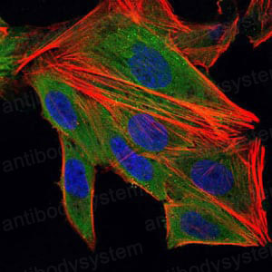 Anti-IL1B/IL1F2 Antibody (R2X46)