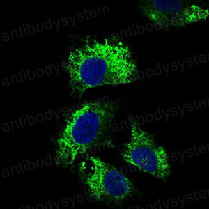 Anti-CD25/IL2RA Antibody (R2X50)