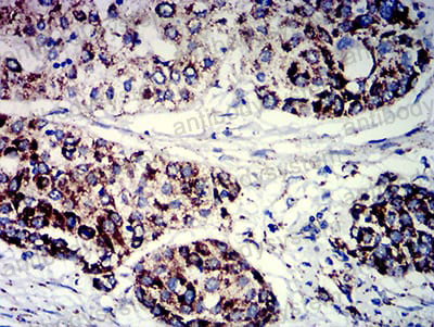 Anti-PIGR Antibody (R2X59)