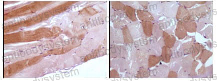 Anti-MB/Myoglobin Antibody (R2X73)
