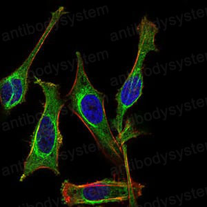 Anti-MB Antibody (R2X74)