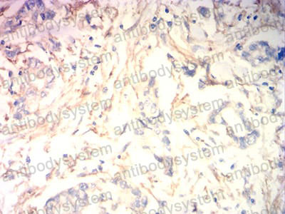 Anti-MB Antibody (R2X75)