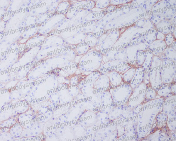 Anti-COL1A1 Antibody (R1A56)