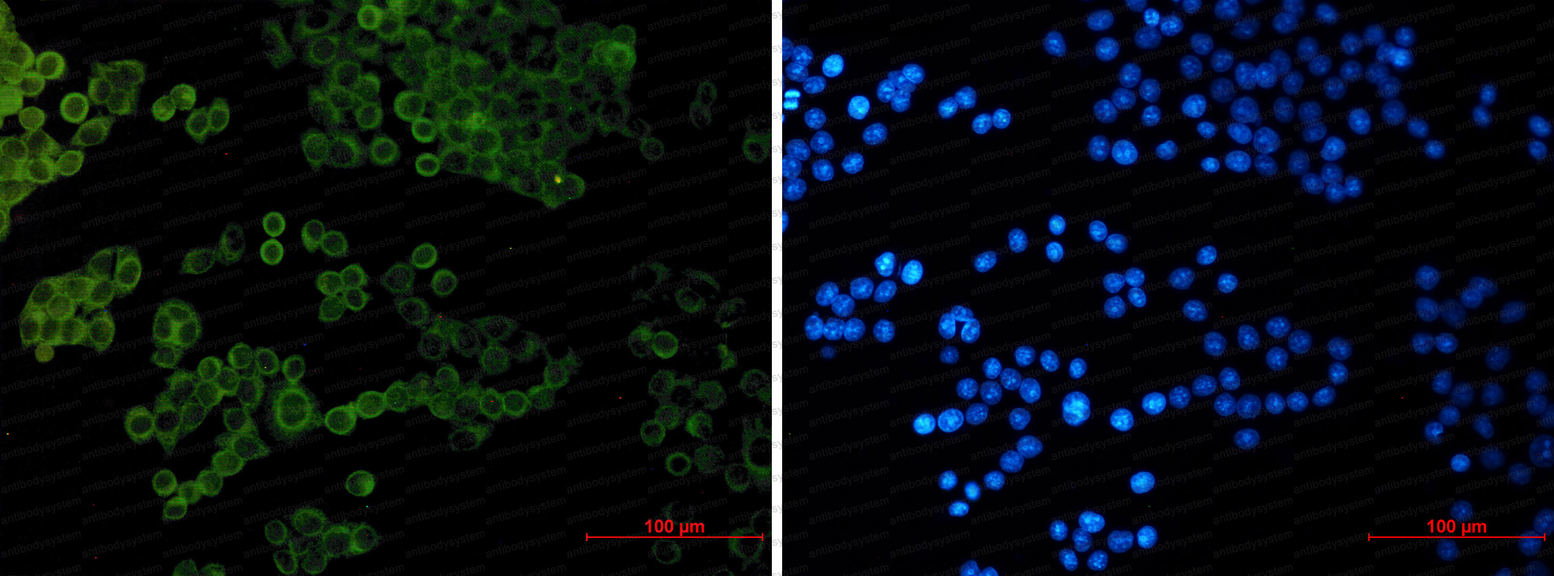 Anti-COL1A1 Antibody (R1H85)
