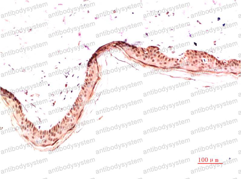 Anti-COL1A1 Antibody (R2X79)