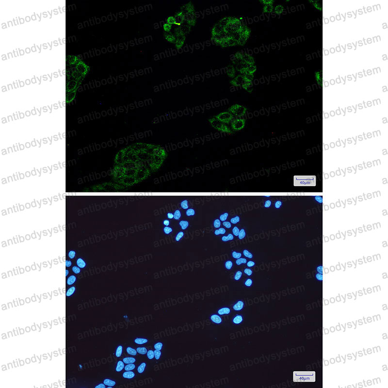 Anti-PIIINP/COL3A1 Antibody (R1H86)