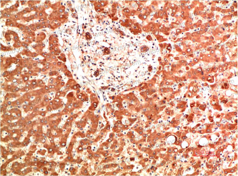 Anti-COL4A1 Antibody (R2X83)
