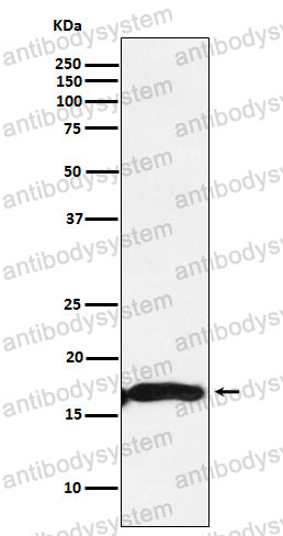 Anti-CRYAA Antibody (R1H87)
