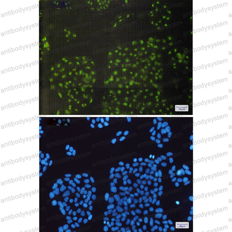 Anti-CRYAB Antibody (R1H88)