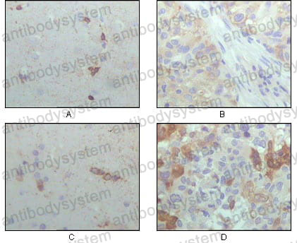 Anti-CRYAB Antibody (R2X85)