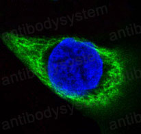 Anti-KRT14 Antibody (R1H90)