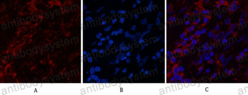 Anti-KRT6A Antibody (R2X91)