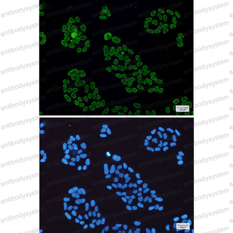 Anti-Lamin A/C Antibody (R1H91)