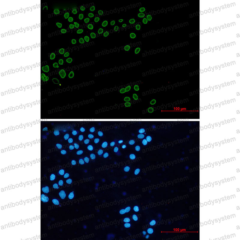 Anti-Lamin A/C Antibody (R1H92)