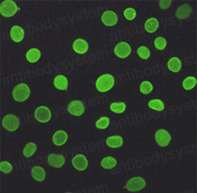 Anti-Lamin A/C Antibody (R2X93)