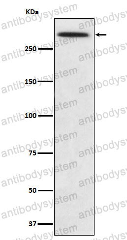 Anti-SPTA1 Antibody (R1H94)