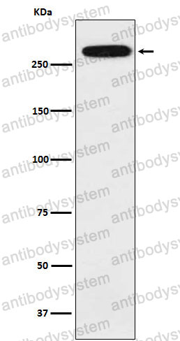 Anti-SPTA1 Antibody (R1H93)