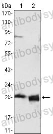 Anti-APOA1 Antibody (R2X95)