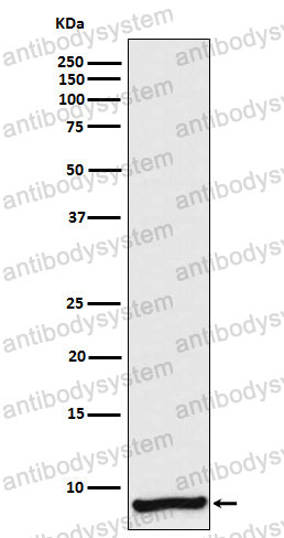 Anti-APOC1 Antibody (R1H96)