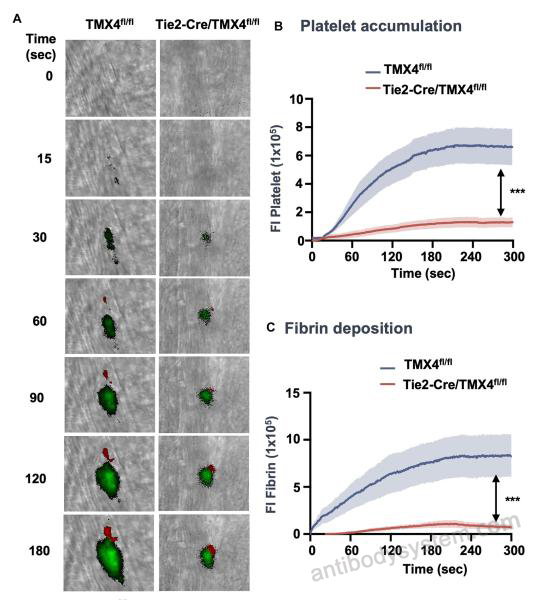 Immunofluorescence for Anti-Human Fibrin Antibody (59D8) ?>