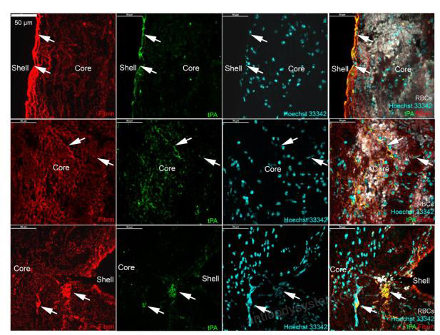Immunofluorescence for Anti-Human Fibrin Antibody (59D8) ?>