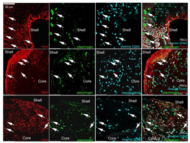 Immunofluorescence for Anti-Human Fibrin Antibody (59D8) ?>