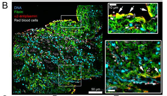 Immunofluorescence for Anti-Human Fibrin Antibody (59D8) ?>