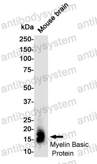 Anti-MBP Antibody (R1J02)