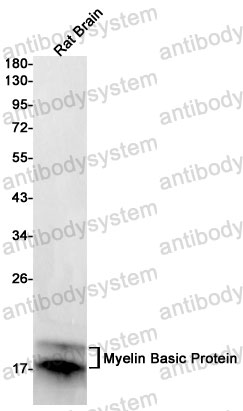 Anti-MBP Antibody (R1H99)