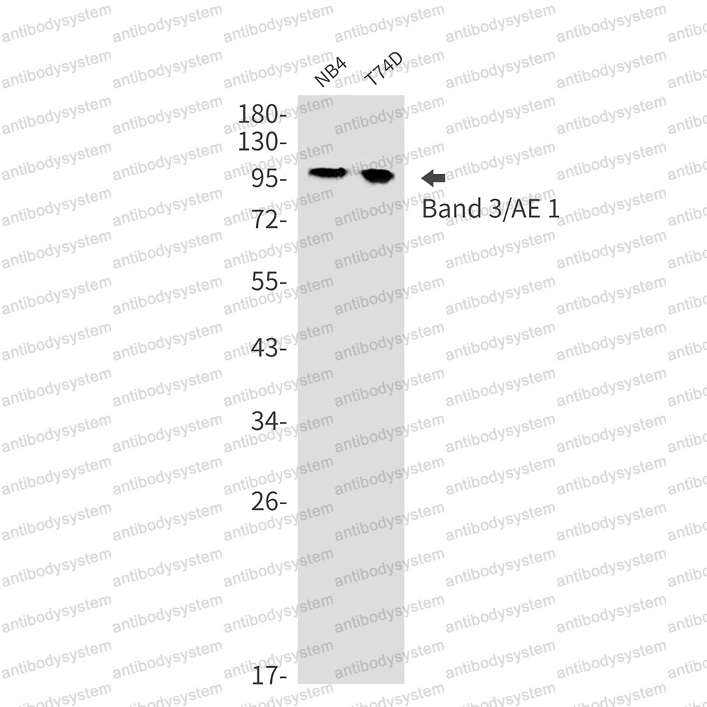 Anti-CD233/SLC4A1 Antibody (R1J04)