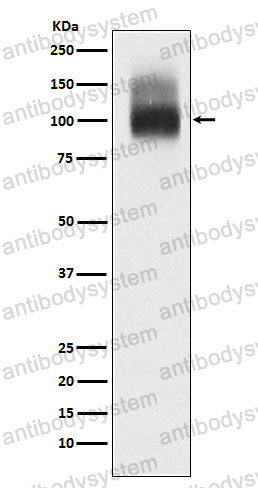 Anti-CD233/SLC4A1 Antibody (R1J03)