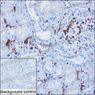 Anti-CD233/SLC4A1 Antibody (R2Y04)