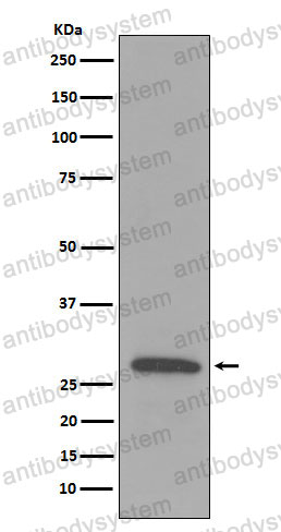 Anti-C1QB Antibody (R1J05)