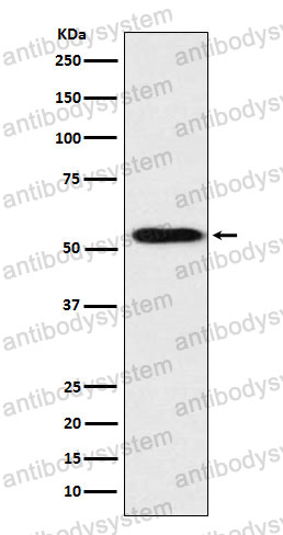 Anti-APOH Antibody (R1J06)