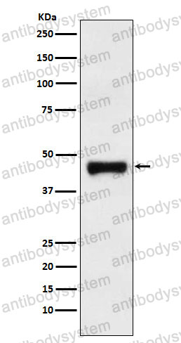 Anti-LRG1 Antibody (R1J07)