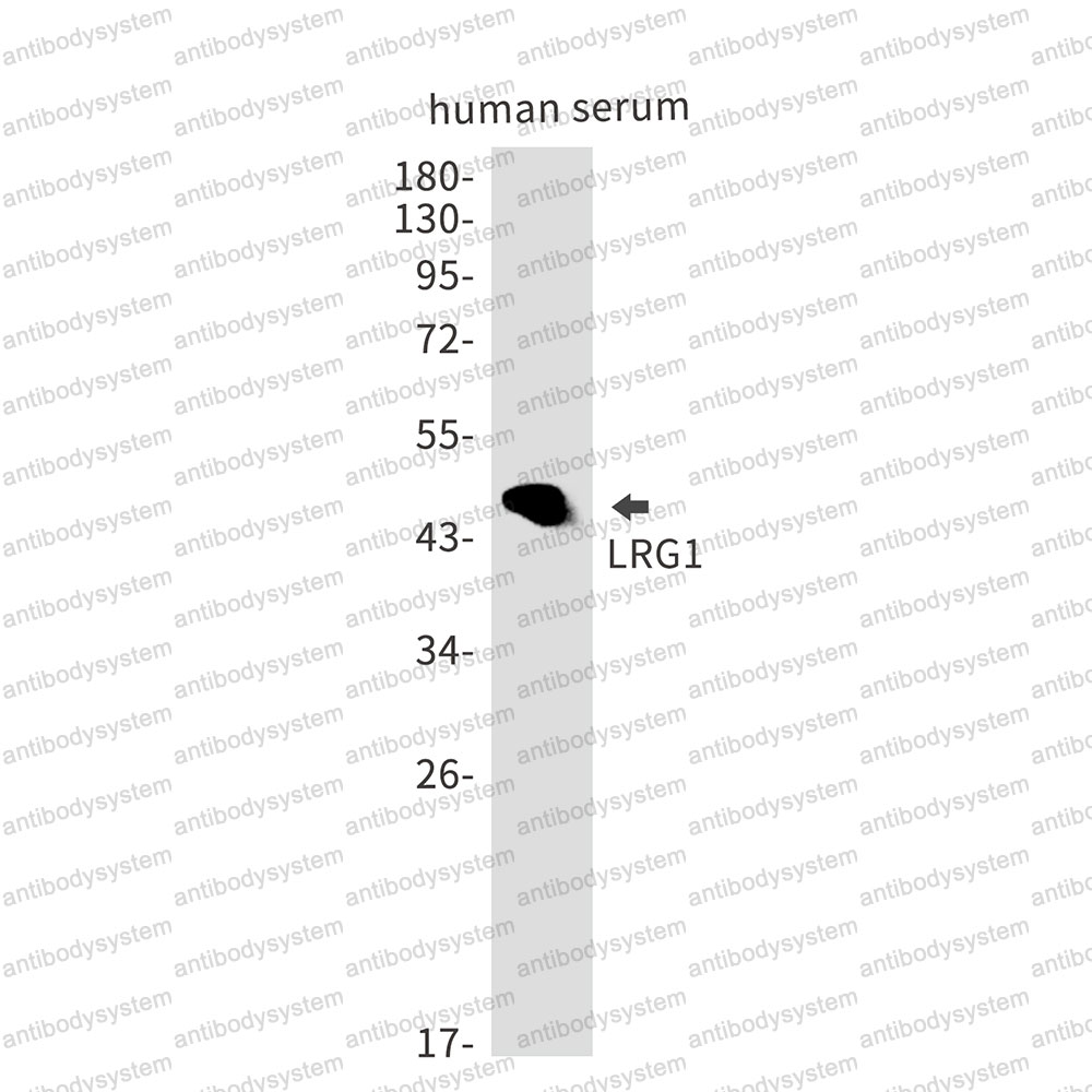 Anti-LRG1 Antibody (R1J08)