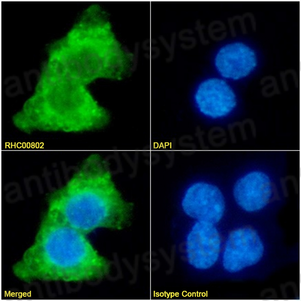 Anti-Human EDB/EDB-FN Antibody (SAA1375)