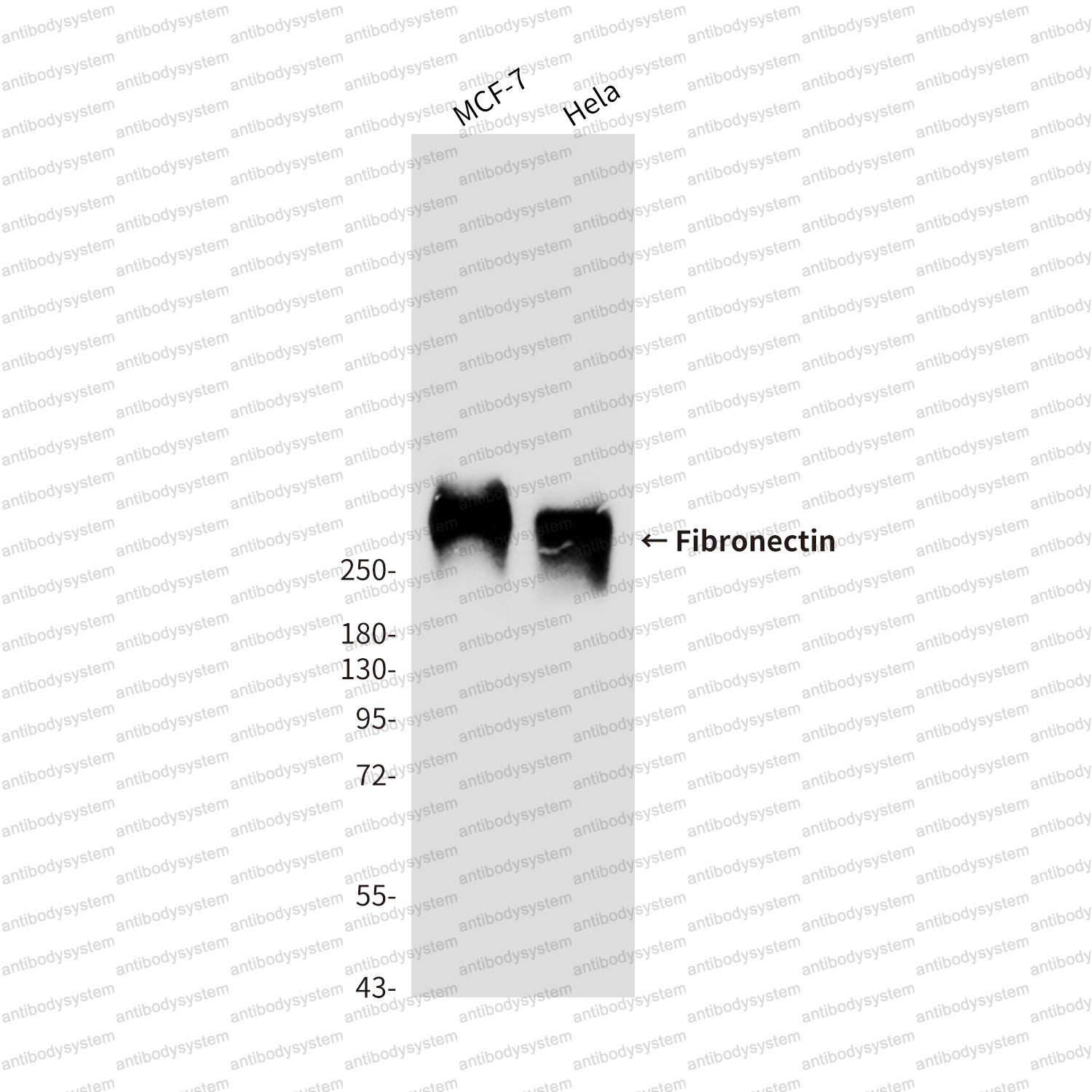 Anti-FN1/Fibronectin Antibody (R2Y12)