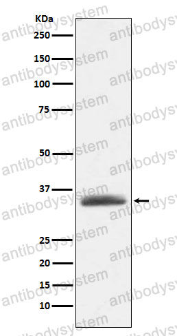Anti-AMBP Antibody (R1J09)