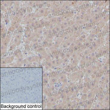 Anti-AMBP Antibody (R2Y14)