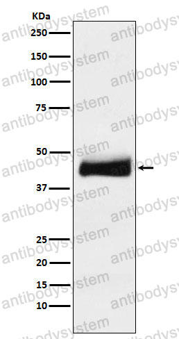 Anti-ORM1/a1AGP Antibody (R1J10)
